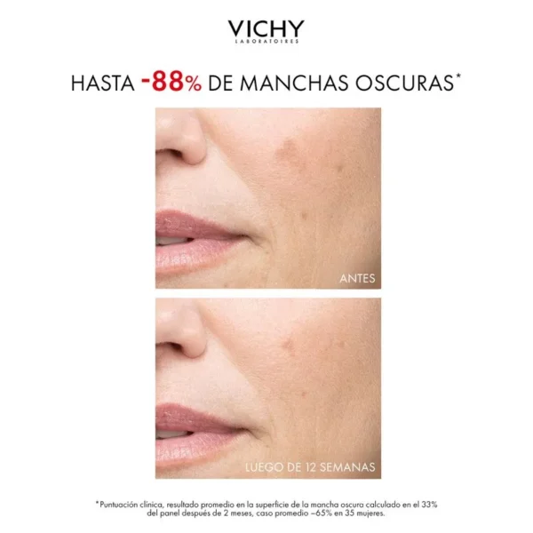 VICHY LIFTACTIV B3 PIGMENT SPECIALIST CREMA ANTI MANCHAS DÍA x50ML - Imagen 4